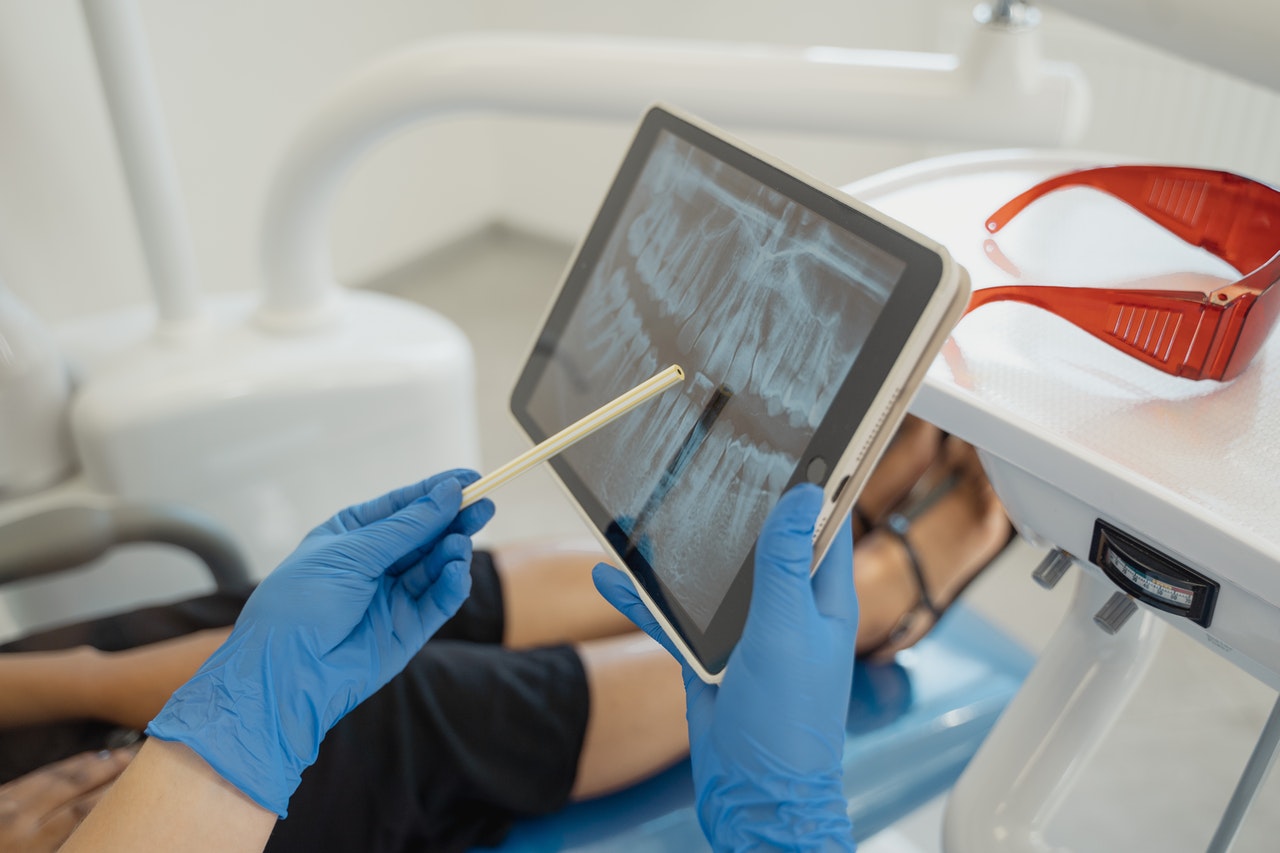 digital scan for evaluating dentures